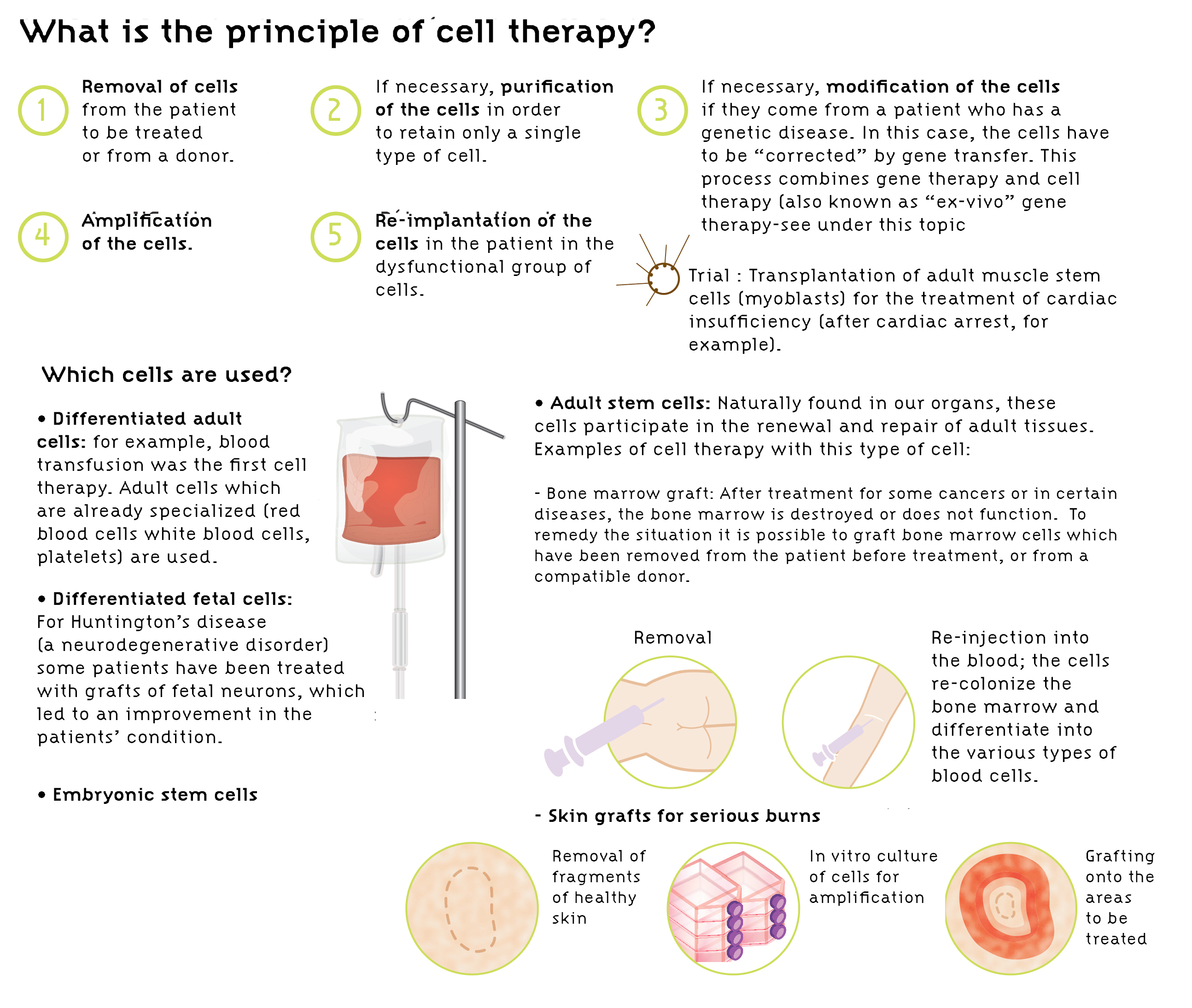 Cell therapy